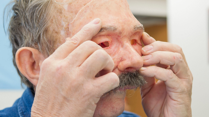 Медицина. Протезы