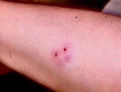 Змеи на даче. Насколько опасна встреча с ними и как защититься?