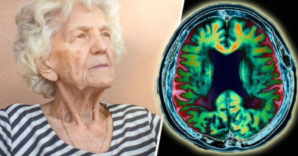 Как избежать деменции и сохранить интеллект до глубокой старости
