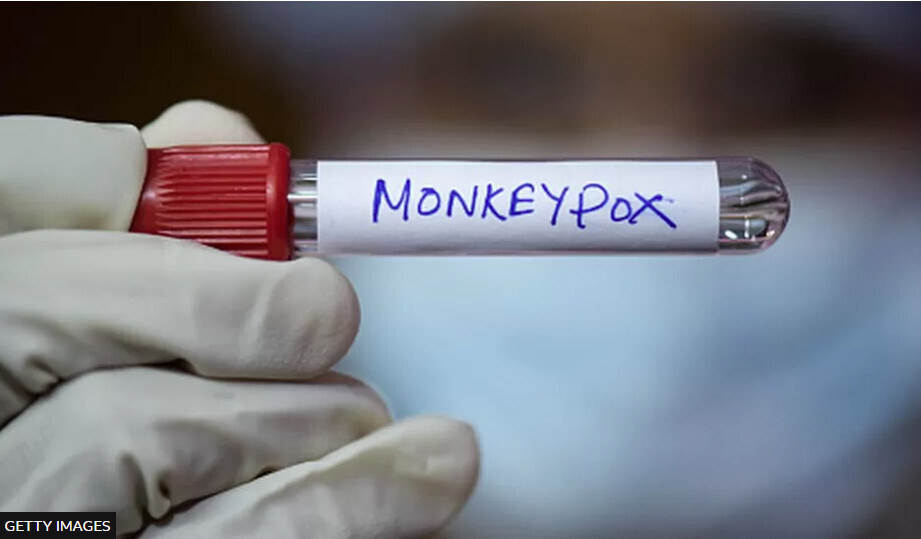 Оспа обезьян: ВОЗ объявляет глобальную чрезвычайную ситуацию оконченной