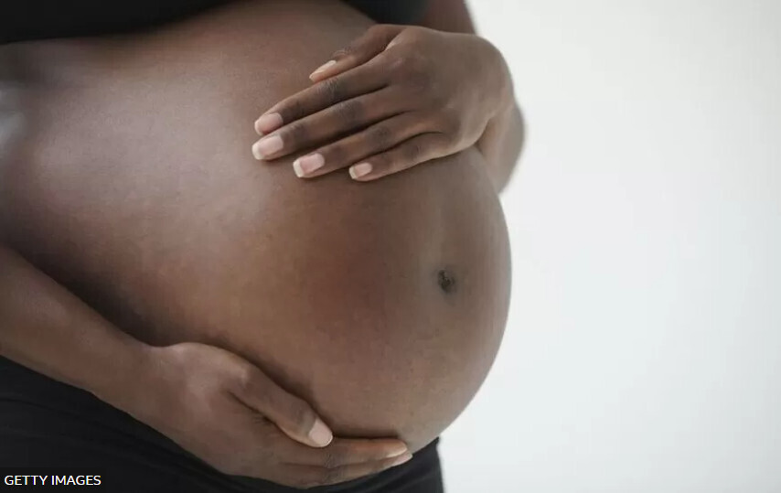 Цифры показывают расовое неравенство материнской смертности