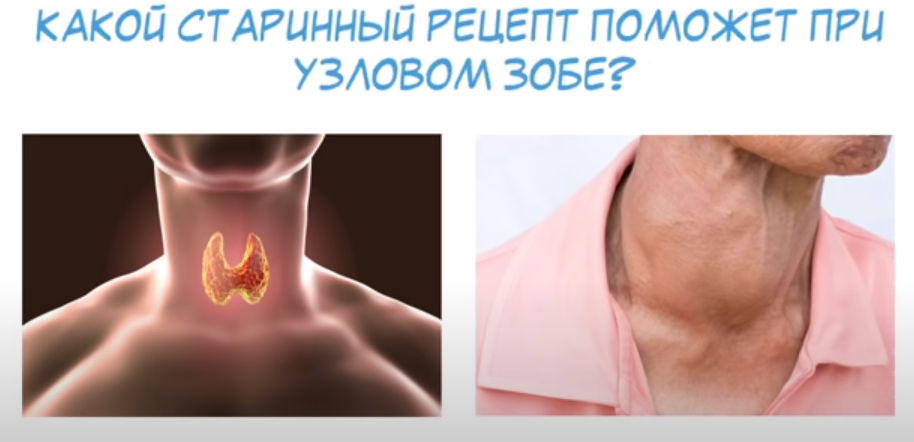 Какую роль играет в организме щитовидная железа?