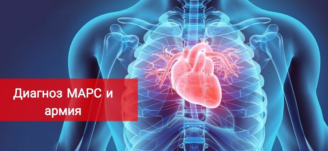 Диагноз МАРС и армия