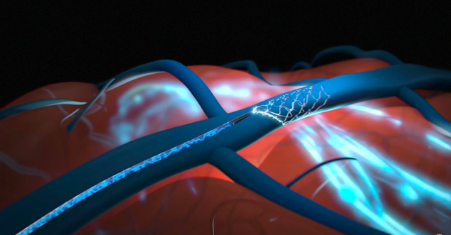Первооткрывателям мозговых имплантатов предстоит долгий путь к рынку и переполненное поле