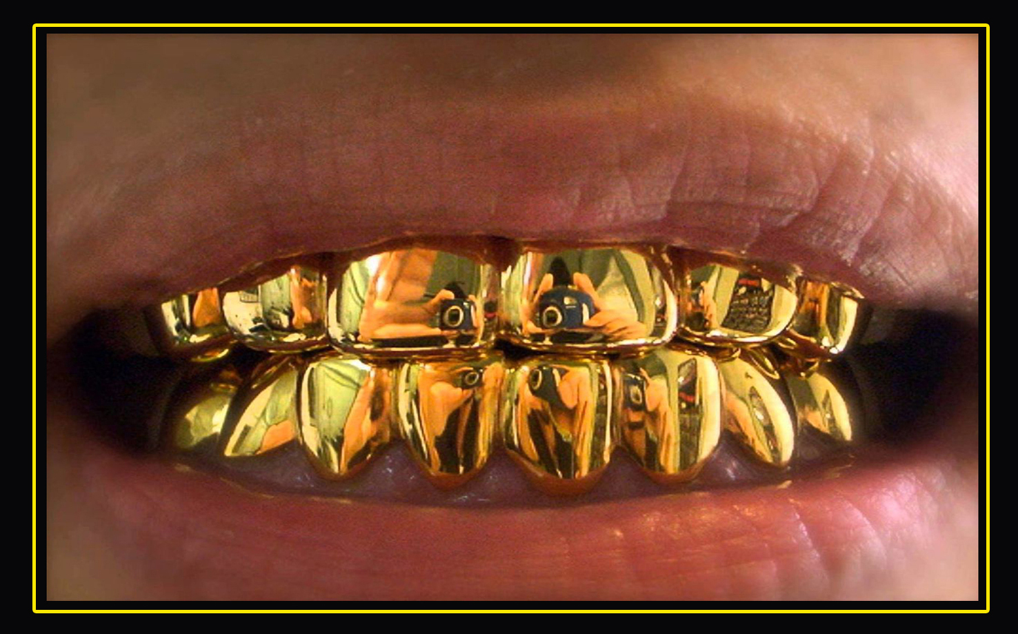 Как сохранить свои зубы полностью целыми до самой смерти, - даже в гробу Вы будете лежать с крепкими, здоровыми зубами!