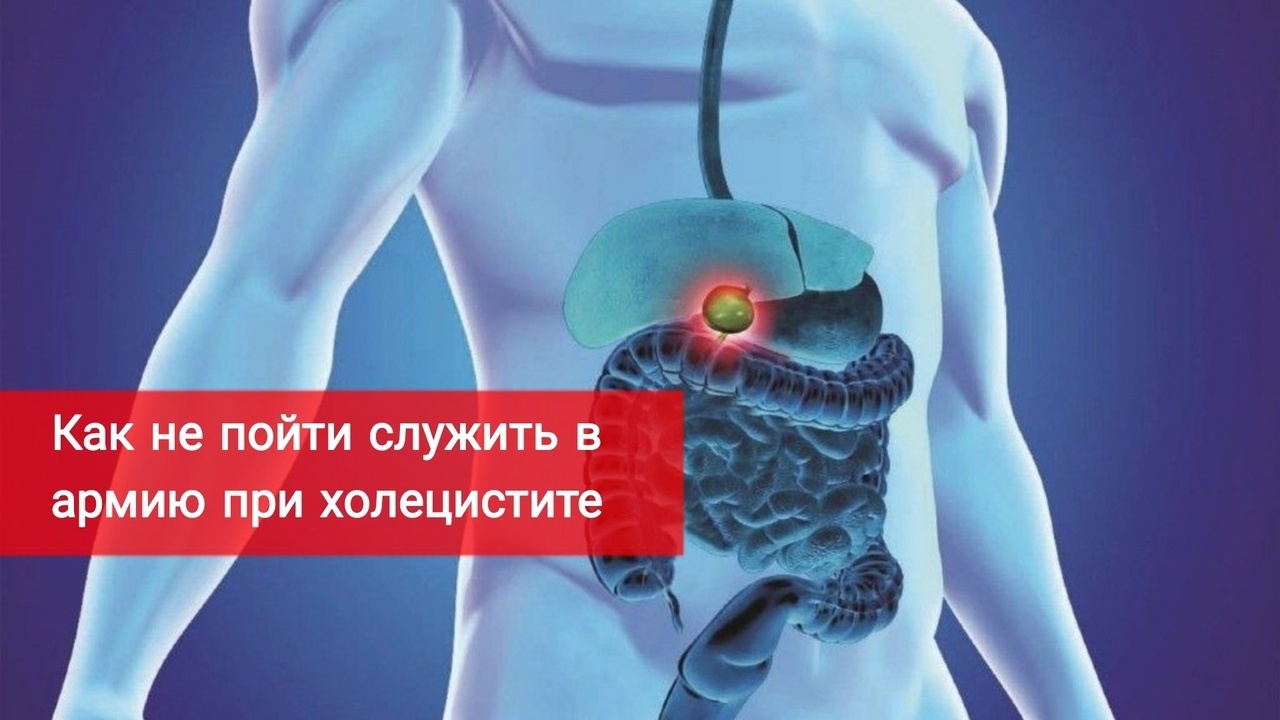 Как не пойти служить в армию при холецистите