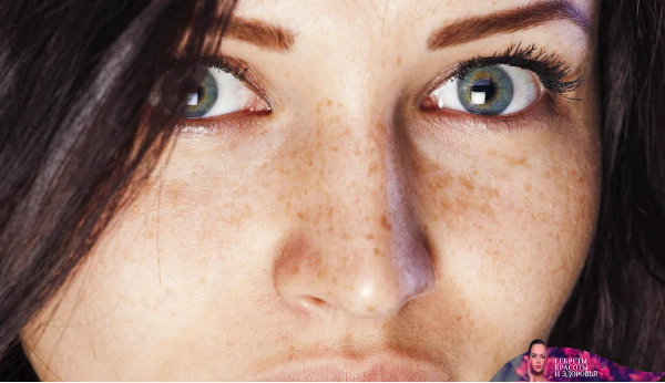 Вот как избавиться от темных пятен естественным путем