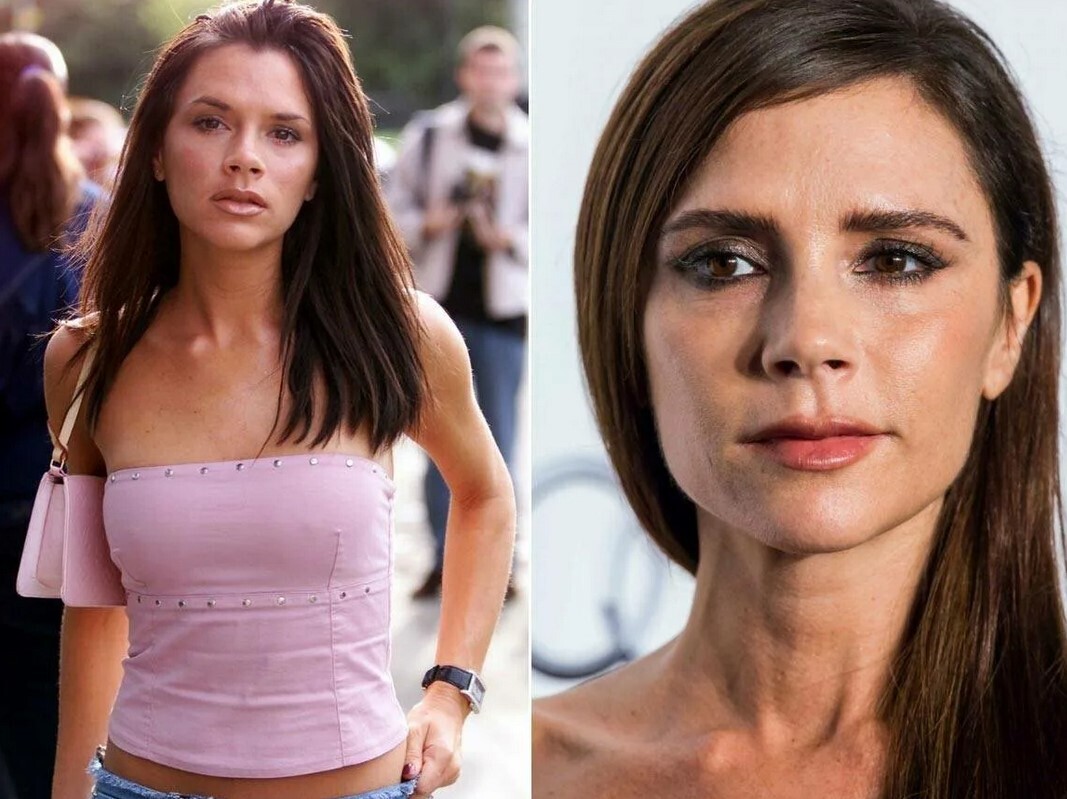 Звезды, которые жалеют, что сделали «пластику»