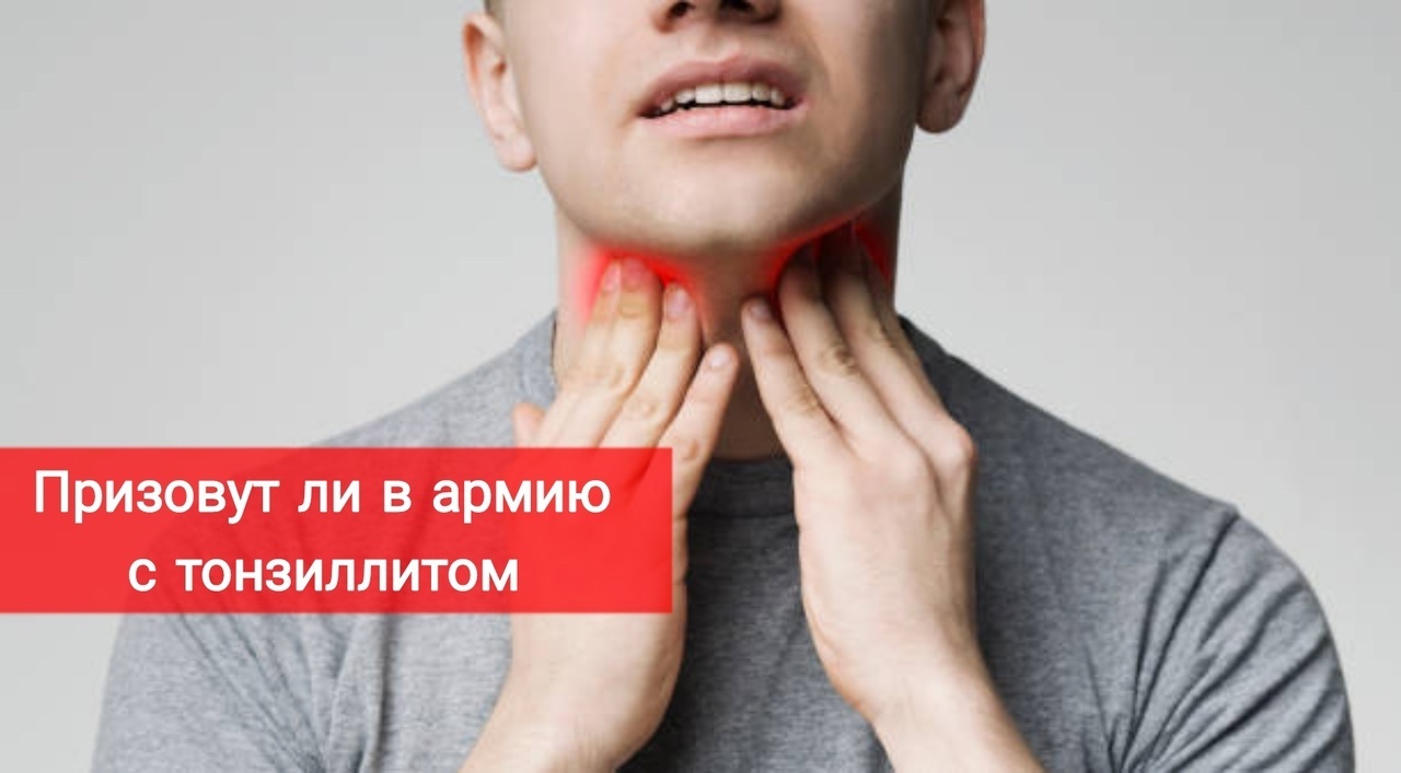 Призовут ли в армию с тонзиллитом
