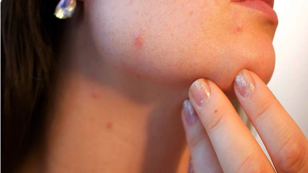 Дерматолог: когда и зачем к нему обращаться?