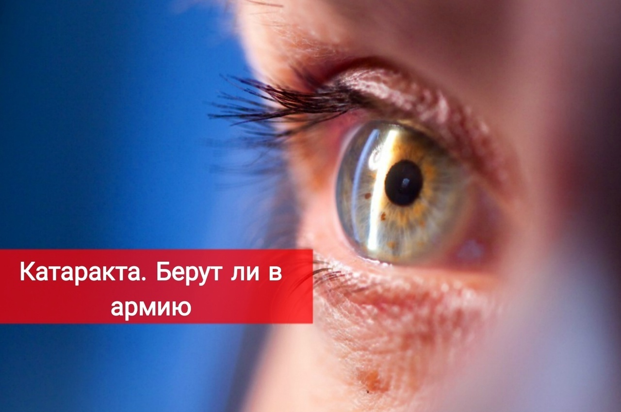 Катаракта. Берут ли в армию