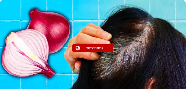 Вот как использовать лук для стимуляции роста волос. Красота и здоровье.
