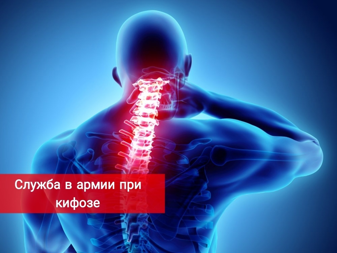 Служба в армии при кифозе