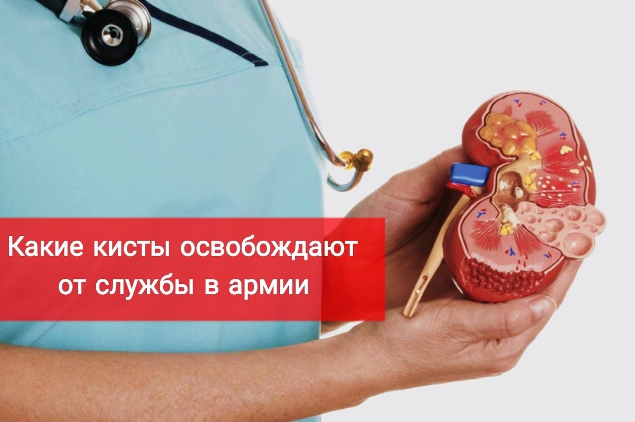Какие кисты освободят от службы в армии