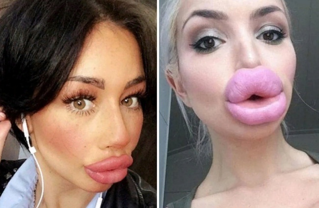 Чего не сделаешь ради красоты!