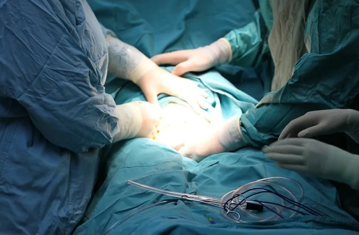 Оказывает ли вмешательство по передаче микробиоты влагалища младенцам, рожденным путем кесарева сечения, благотворное влияние на их нейроразвитие?