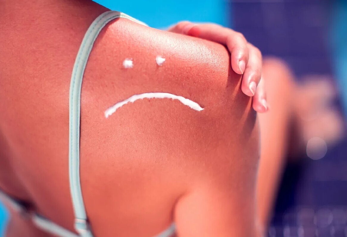 Почему некоторые люди быстро загорают, а другие быстро обгорают?