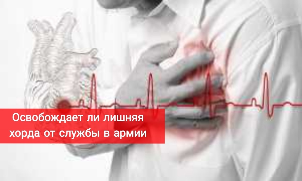 Освобождает ли лишняя хорда от службы в армии