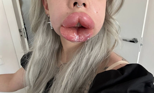 Блогер и модель Картье Бугатти столкнулась с серьезными осложнениями