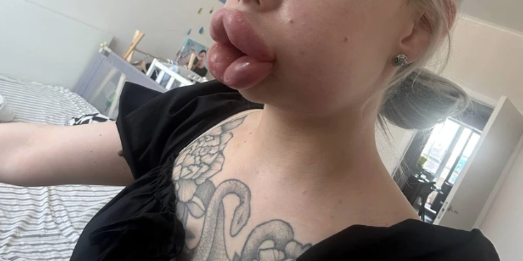 Блогер и модель Картье Бугатти столкнулась с серьезными осложнениями