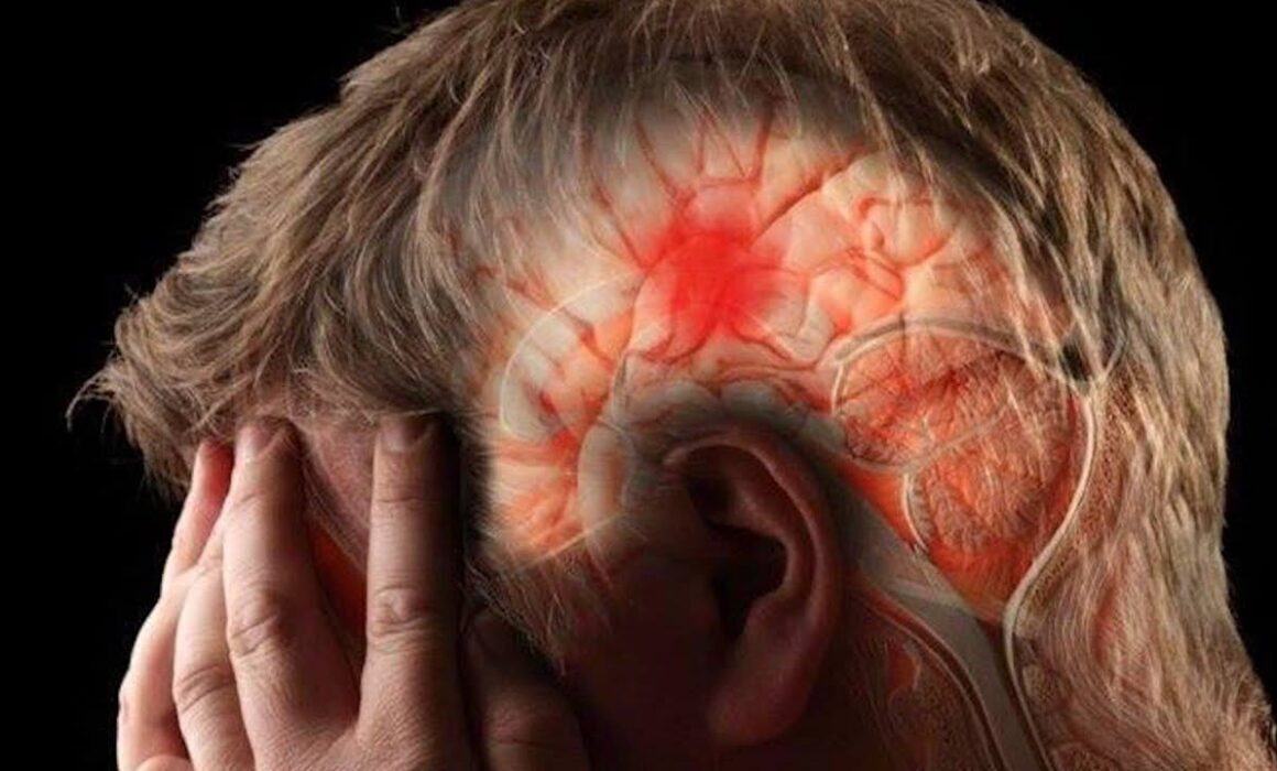 ИНСУЛЬТ. Есть ли у вас факторы риска развития инсульта и как его избежать? Узнайте сейчас