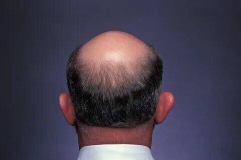 Почему женщинам нравятся лысые мужчины.