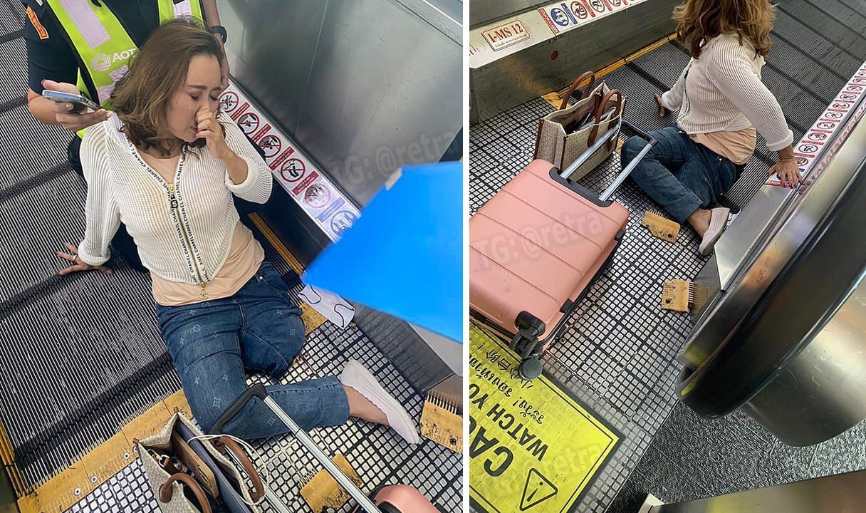 В аэропорту Бангкока эскалатор зажевал ногу женщины так, что её пришлось ампутировать.