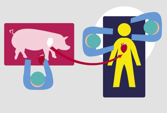 Опыт пересадки генетически модифицированного сердца свиньи