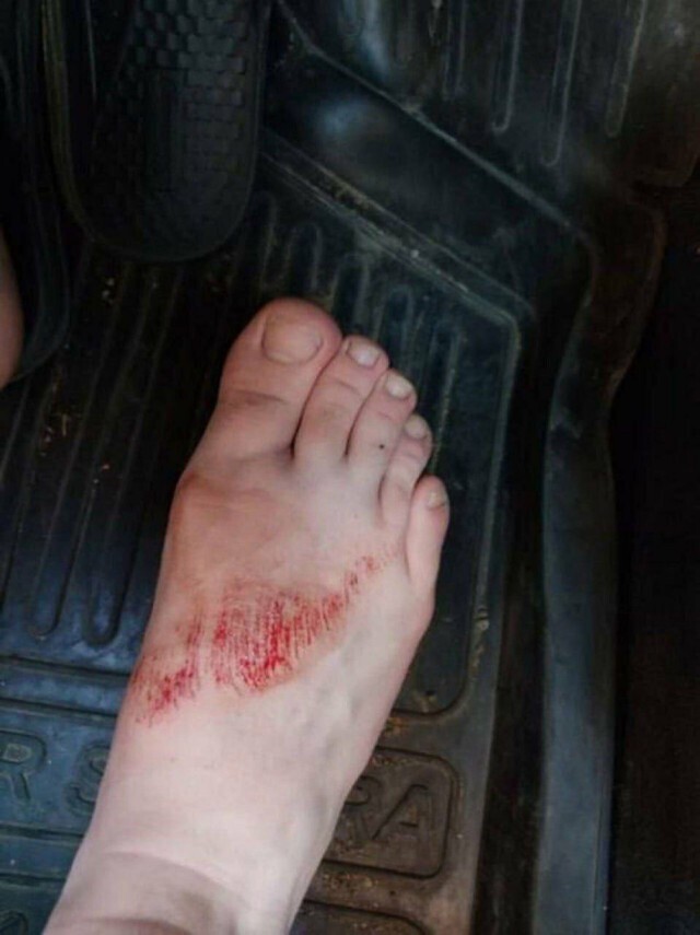 Сом напал на ребенка и попытался утащить на дно