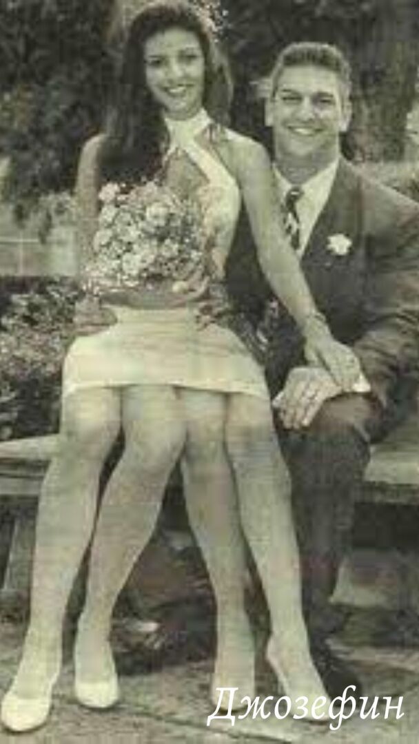 Джозефин Миртл Корбин: 4 факта о четырехногой женщине, которые вызывают шок