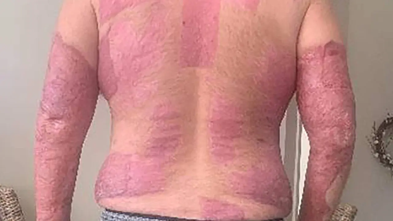 ‘Как в духовке, но в 1000 раз хуже’: туристы описывают ужас извержения на острове Уайт