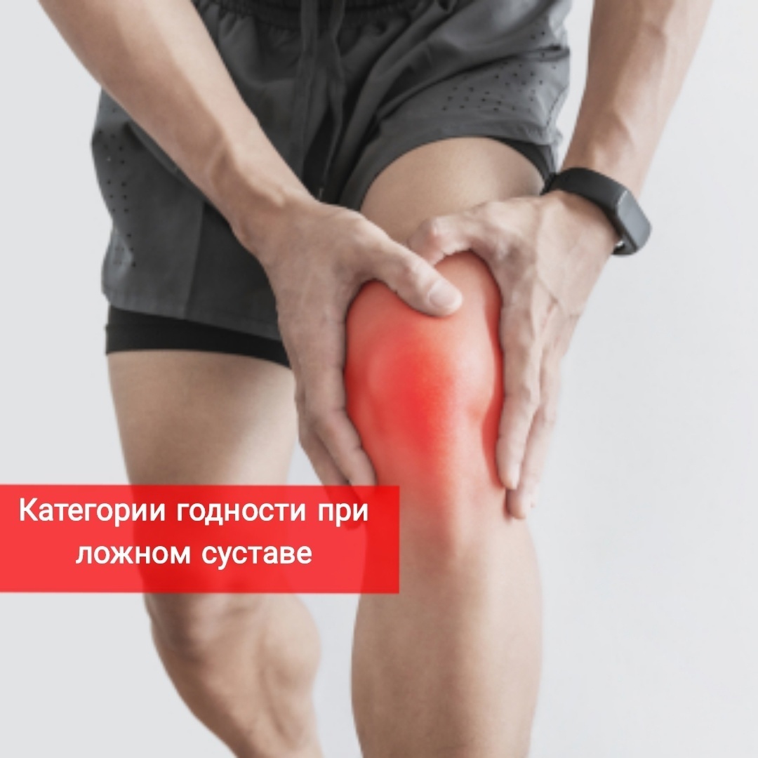 Категории годности при ложном суставе