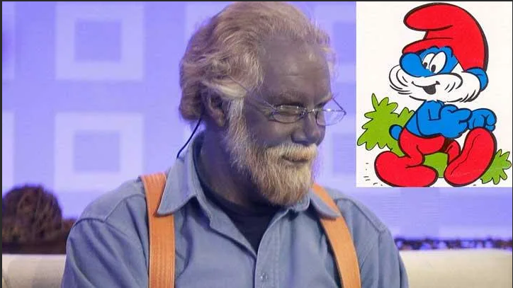 Патология, которая делает людей привлекательными, или Трагическая красота