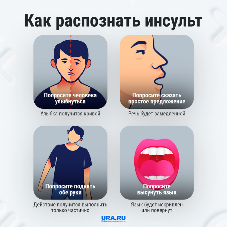 Инсульт - первые признаки. Профилактика