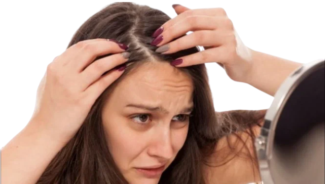 Как избавиться от перхоти - народное средство. Красота и здоровье