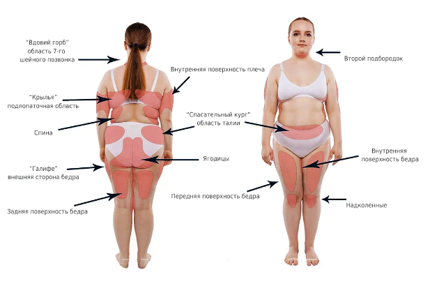 5 законов похудения: вот как похудеть в каждой части тела.