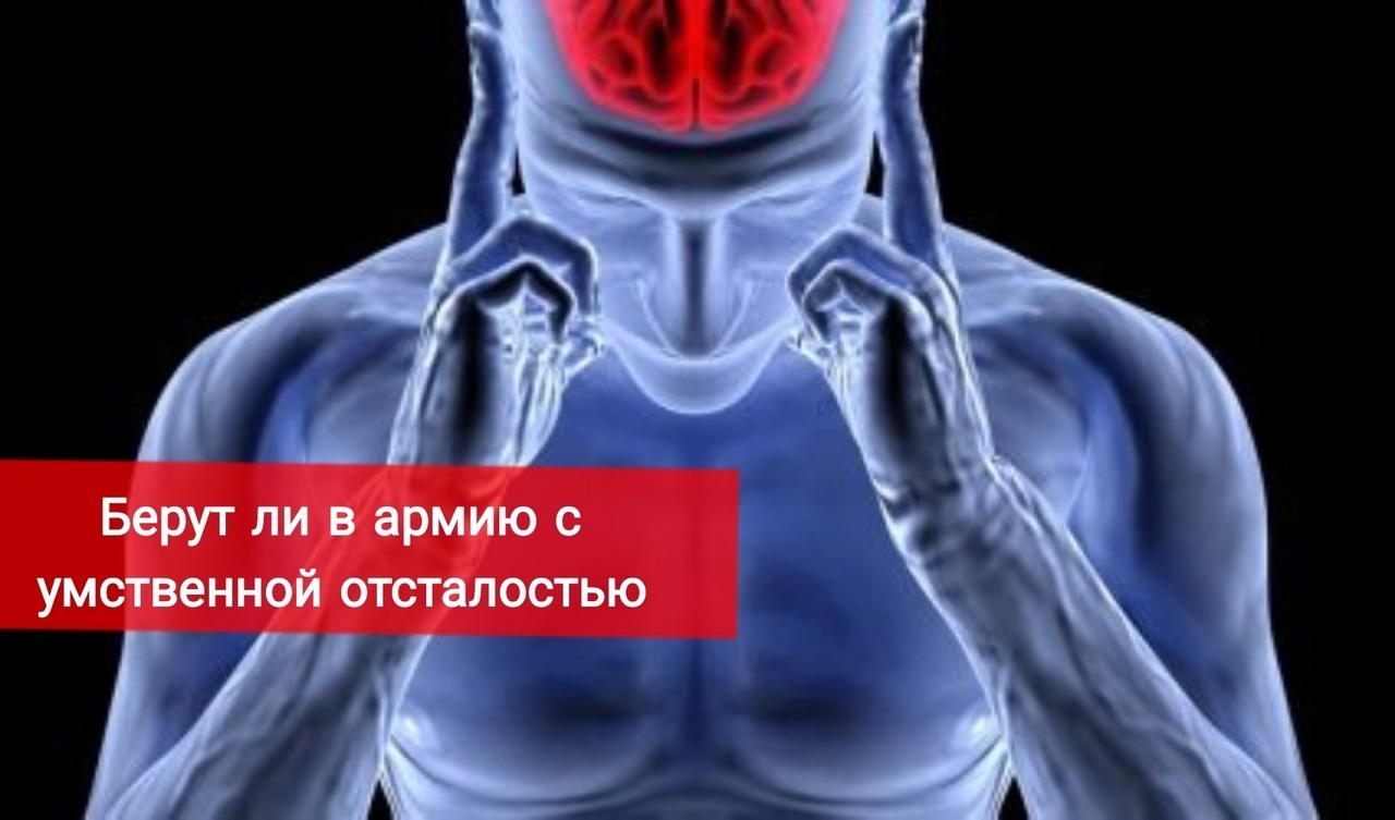 Берут ли умственно отсталых в армию