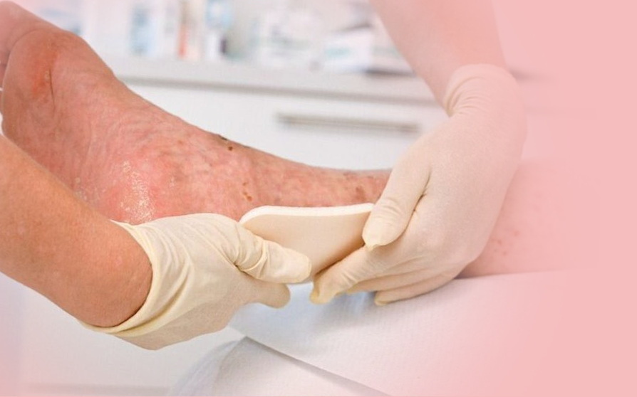 Мазь от пролежней