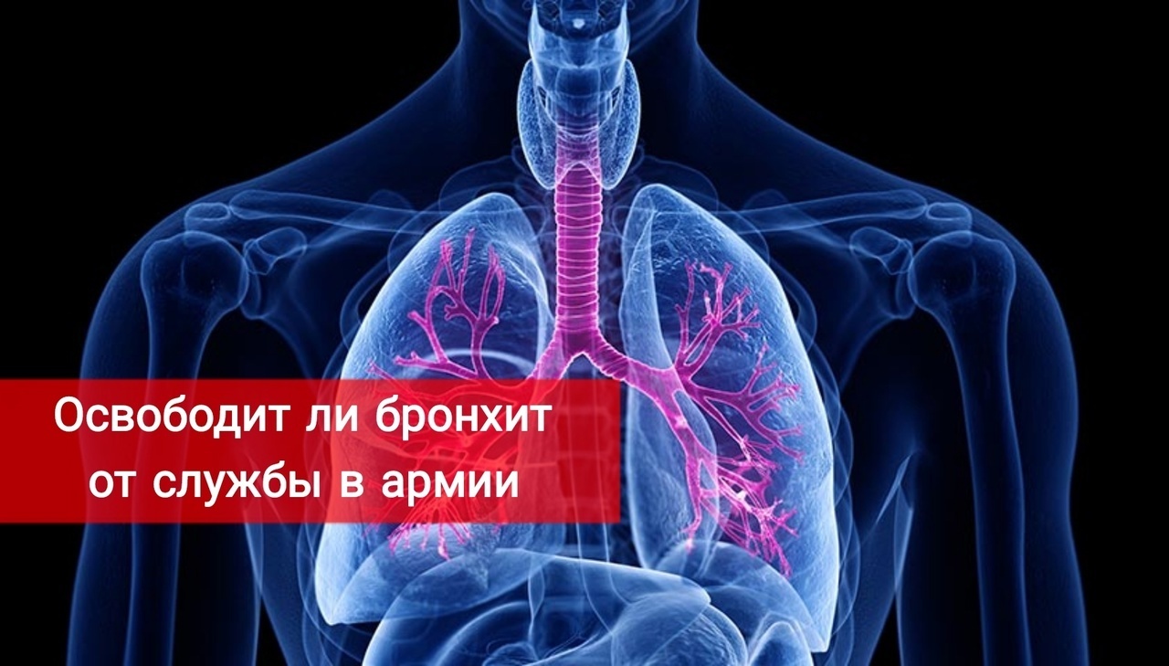 Может ли быть бронхит. Могут ли в бронхах жить паразиты. диагностика бронхита картинки. бронхит ложат ли в больницу.