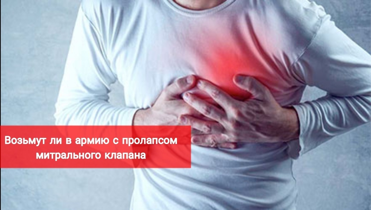 Возьмут ли в армию с пролапсом митрального клапана