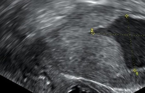 Сумасшедшие факты о сексе с древних времен