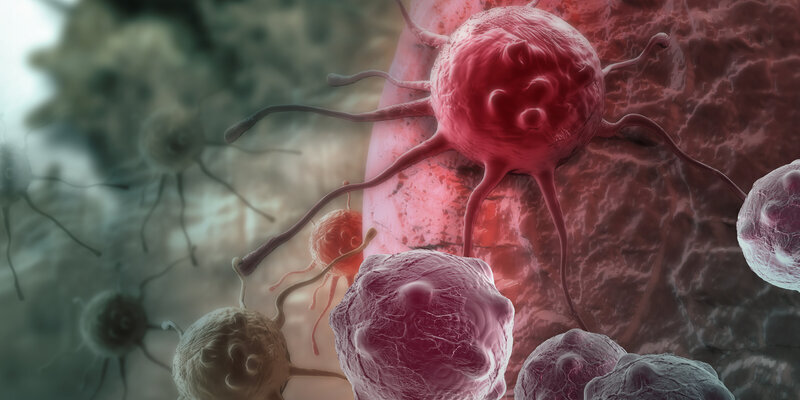 Симптомы, предшествующие агрессивному раку: открытие, которое может спасти жизни