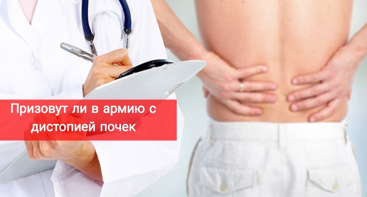 Призовут ли в армию с дистопией почек