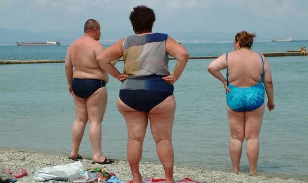 Ожирение в России. Неинфекционная пандемия