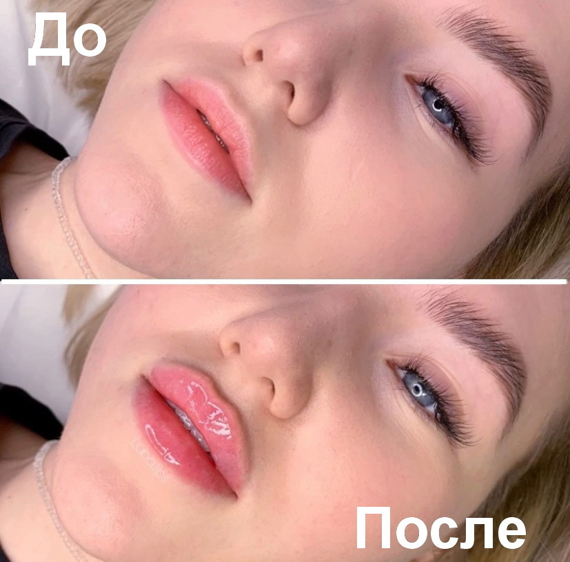 Как красивей, До или После?