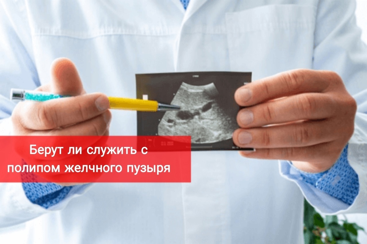 Берут ли служить с полипом желчного пузыря