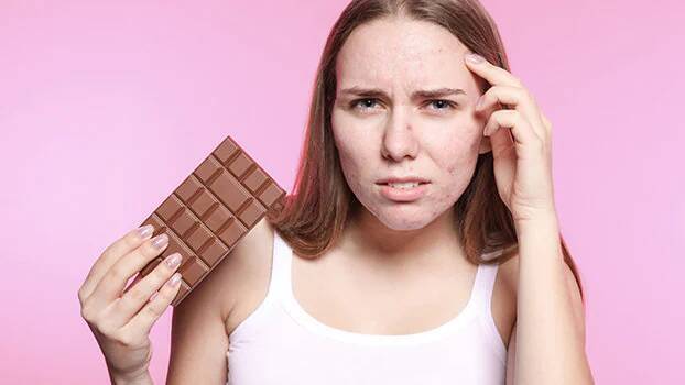 Прыщи и еда!