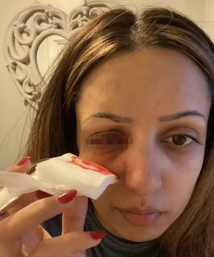 Девушка из Британии ослепла от похода в общественный бассейн.