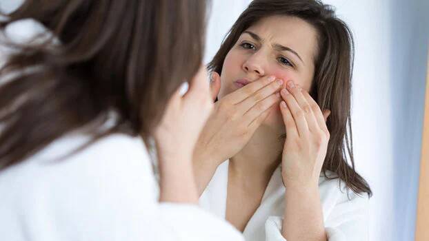 Розацеа: вот доступные методы лечения.