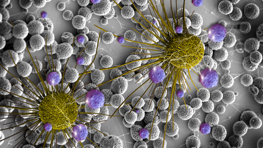 Искусственный интеллект открывает новые возможности в борьбе с раком
